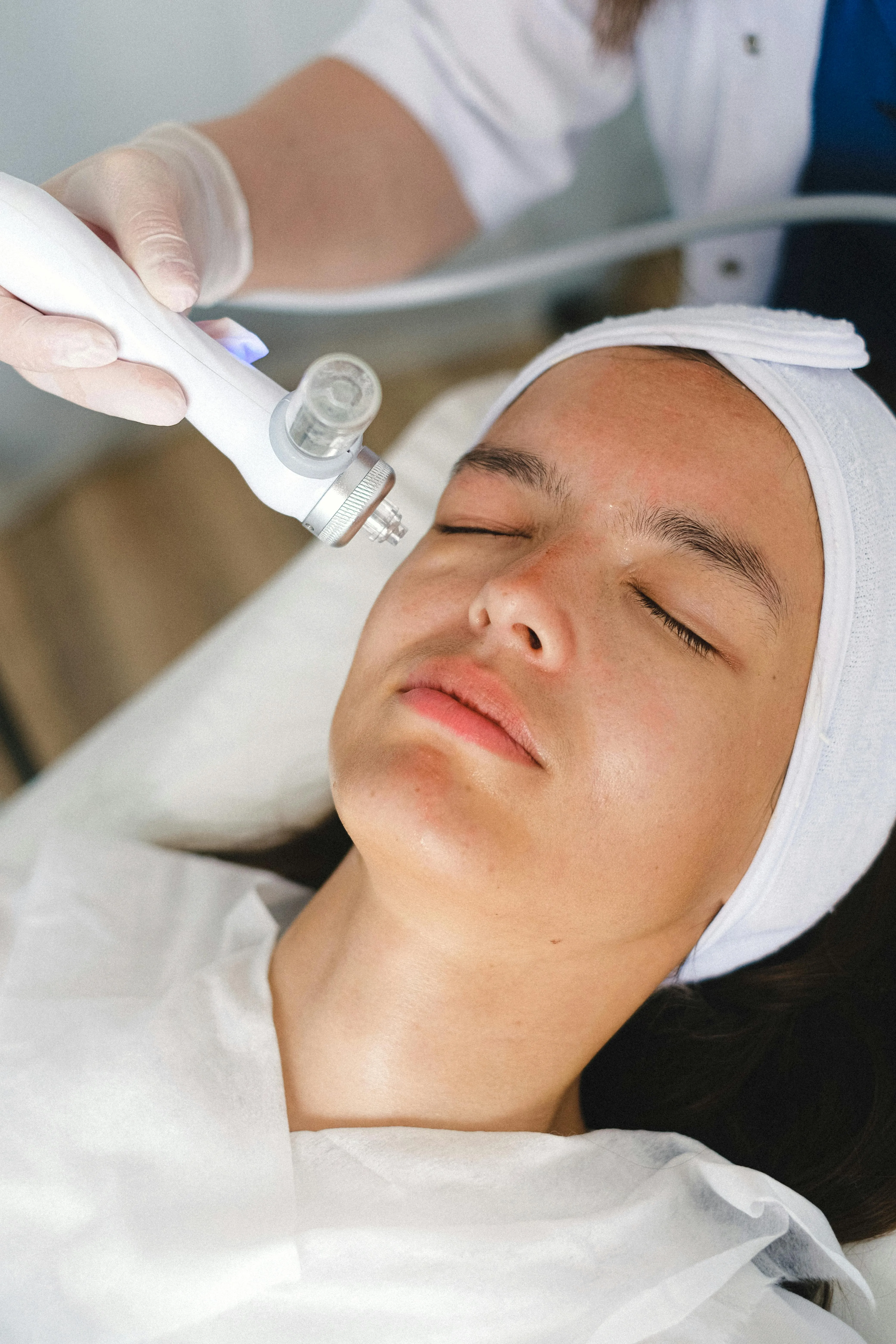 MICRONEEDLING Behandlung bei Glow by Maja